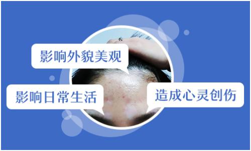 杭州儿童患有白癜风有哪些危害呢